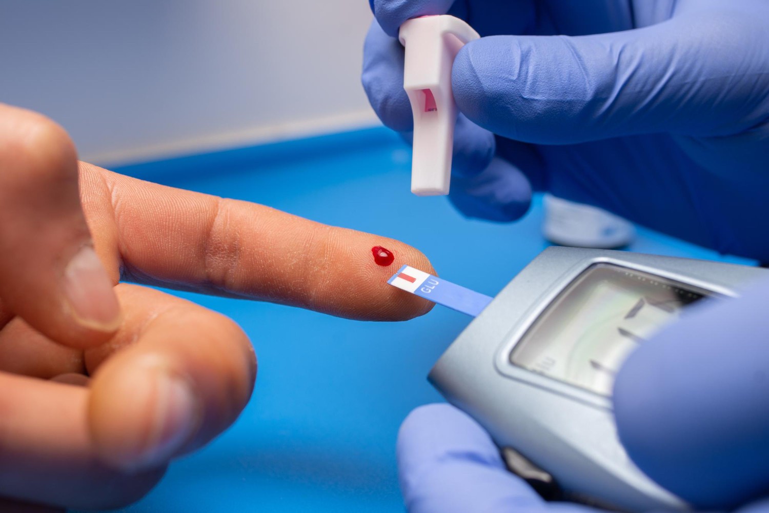 Cukrzyca wymaga stałego monitorowania poziomu glukozy we krwi /Fot. Freepik
