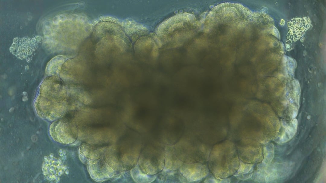 Mózg w wersji mini potrafi się uczyć. Eksperyment budzi zachwyt i pytania