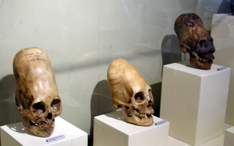 Stożkowate czaszki z Peru znowu szokują świat nauki. Analizy DNA nie potwierdzają ich ziemskiego pochodzenia